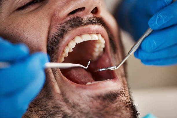 Best Emergency Treatment for Dental Infections or Abscesses in Red Oak, TX